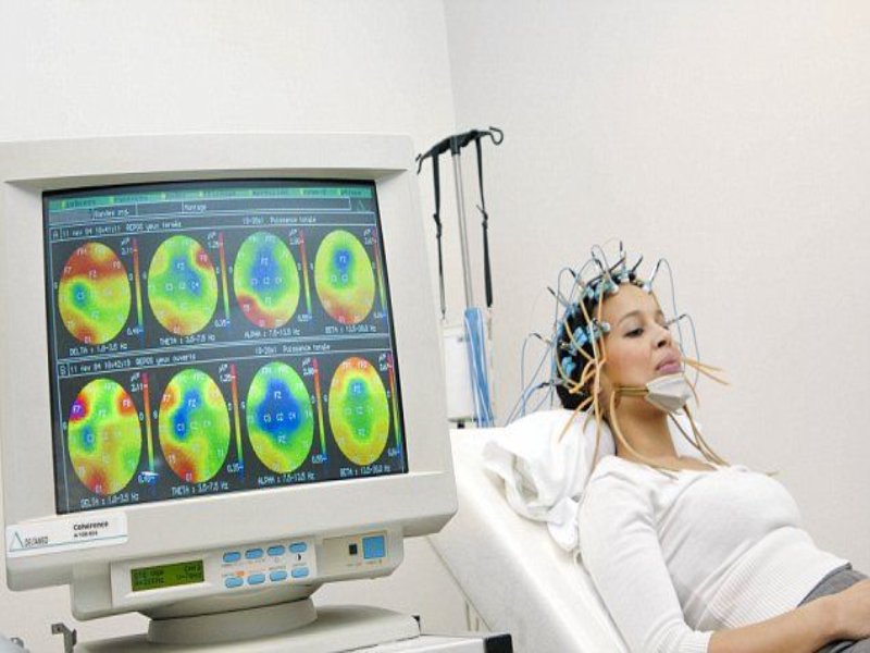 Electroencephalogram (EEG) systems